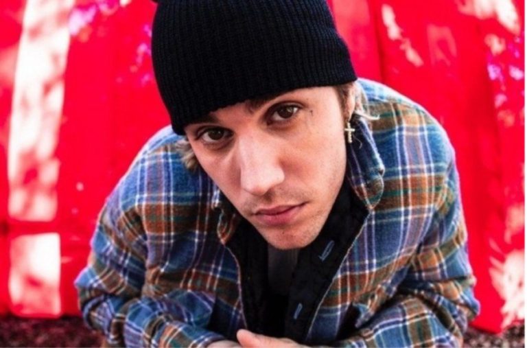 Konser Terancam Batal, Justin Bieber Ungkapkan Didiagnosis Virus Sebabkan Wajahnya Lumpuh