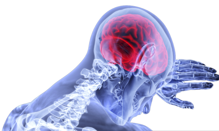 Menangani Penyakit Stroke Ternyata Faktor Waktu Sangat Berperan Penting