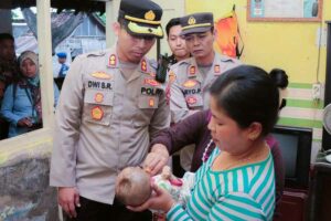 Bayi 8 Bulan Idap Meningokel, Kapolres Situbondo Beri Santunan