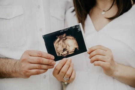 7 Pertanyaan Wajib untuk USG Kandungan pada Trimester Kedua, Simak Baik-baik Ya Bunda!