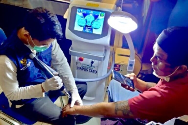 Pemkot Jakarta Pusat Gelar Program Hapus Tato Gratis di Kantor Wali Kota