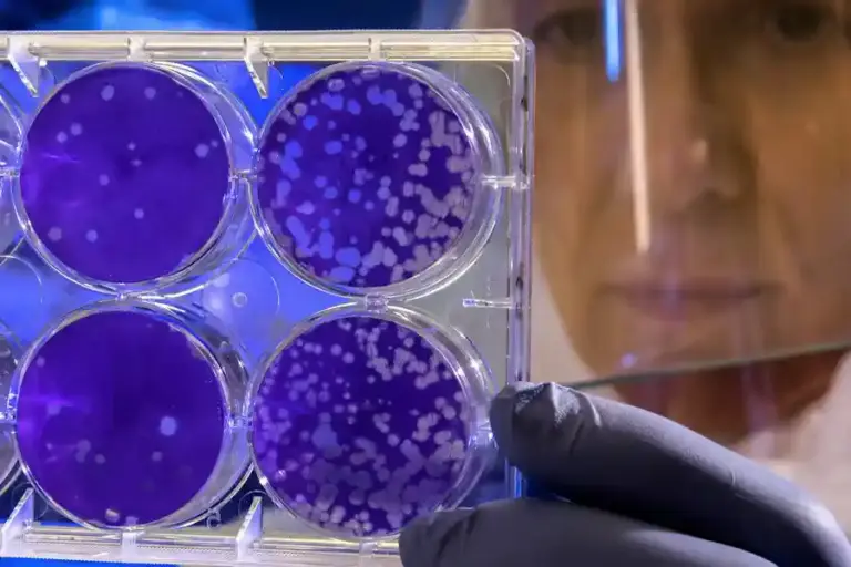 Wabah Virus Nipah di India Merebak, Tenaga Medis Terinfeksi dan Puluhan Warga Dikarantina Ilustrasi penelitian medis (foto: CDC, unsplash)
