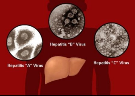 Kesiapan Fasilitas Kesehatan, Respon Cepat Masuknya Hepatitis Akut Diinstruksikan Gubernur Kaltara