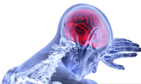 Menangani Penyakit Stroke Ternyata Faktor Waktu Sangat Berperan Penting