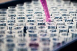Ilustrasi laboratorium kesehatan (foto: unsplash)